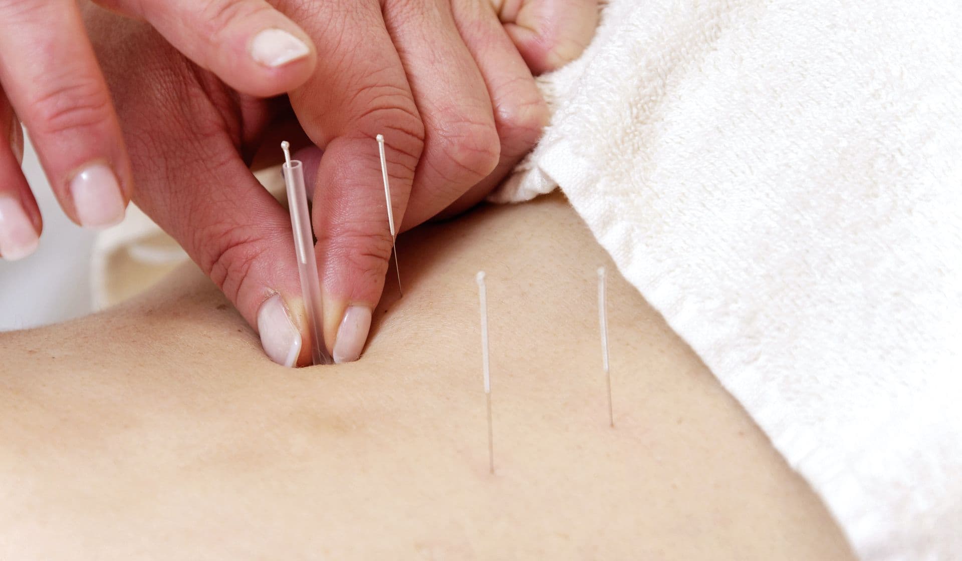 Traditionelle Chinesische Medizin